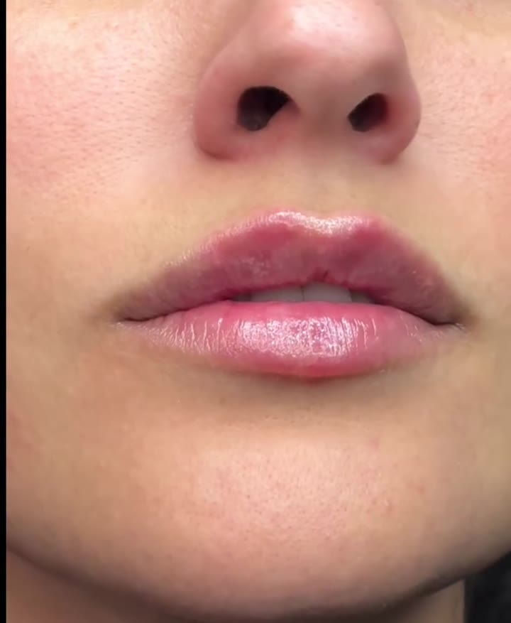 ابتسامة أوضح